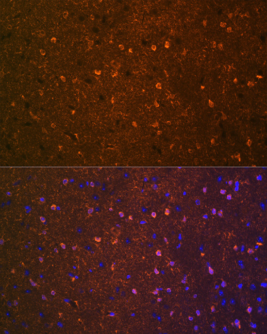 BDNF Rabbit monoclonal antibody