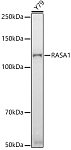 Western blot - RASA1 Rabbit mAb (A4876)