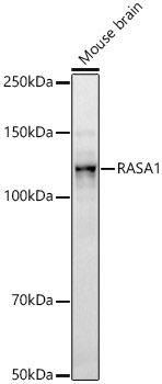 RASA1 Rabbit monoclonal antibody