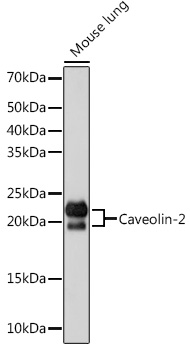 Caveolin-2 Rabbit monoclonal antibody