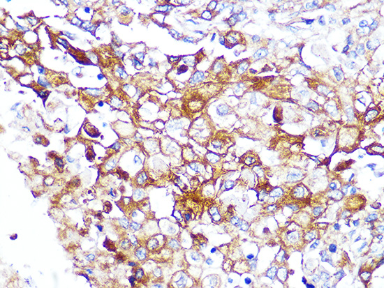 Caveolin-2 Rabbit monoclonal antibody