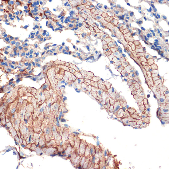 Caveolin-3 Rabbit monoclonal antibody