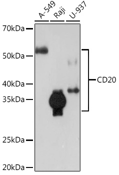 CD20 Rabbit monoclonal antibody