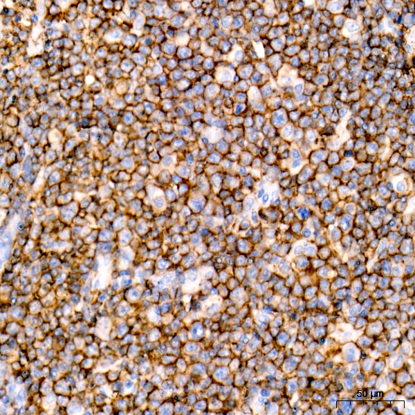 CD20 Rabbit monoclonal antibody