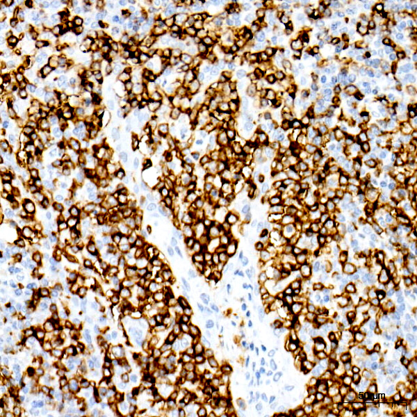 CD20 Rabbit monoclonal antibody