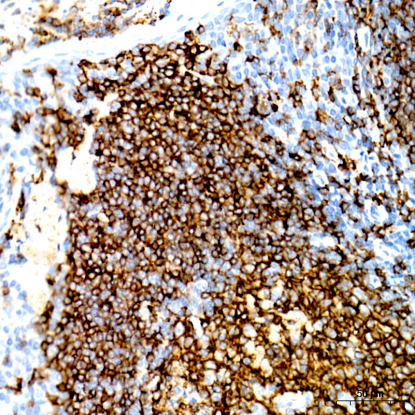 CD20 Rabbit monoclonal antibody
