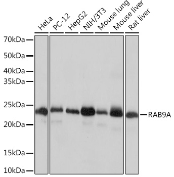 RAB9A Rabbit monoclonal antibody