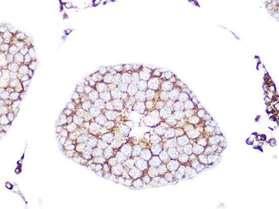 RAB9A Rabbit monoclonal antibody