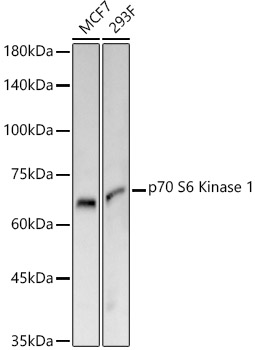 p70 S6 Kinase 1 Rabbit monoclonal antibody