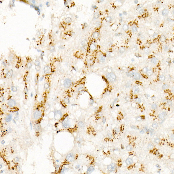 p70 S6 Kinase 1 Rabbit monoclonal antibody