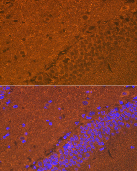 alpha + beta Synuclein Rabbit monoclonal antibody
