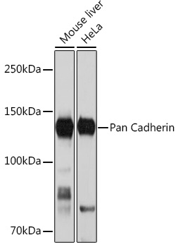 Pan Cadherin Rabbit monoclonal antibody