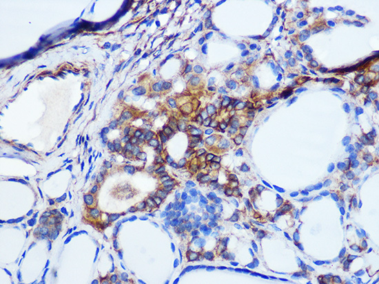 Pan Cadherin Rabbit monoclonal antibody