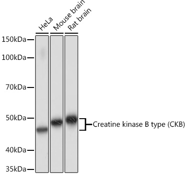 Creatine kinase B type (CKB) Rabbit monoclonal antibody