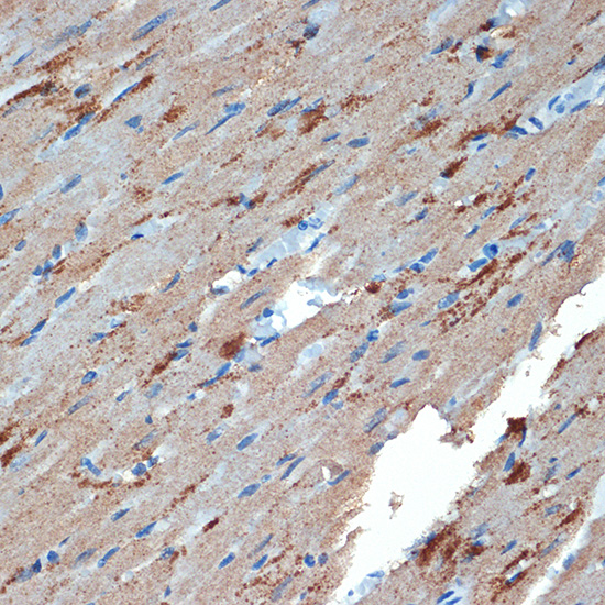 Creatine kinase B type (CKB) Rabbit monoclonal antibody