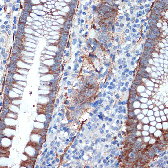Creatine kinase B type (CKB) Rabbit monoclonal antibody