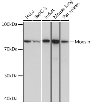 Moesin Rabbit monoclonal antibody