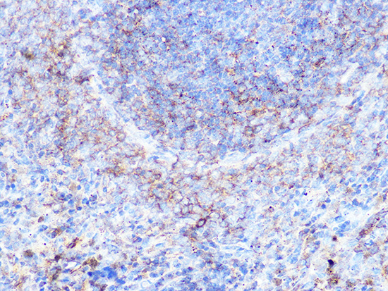 Moesin Rabbit monoclonal antibody
