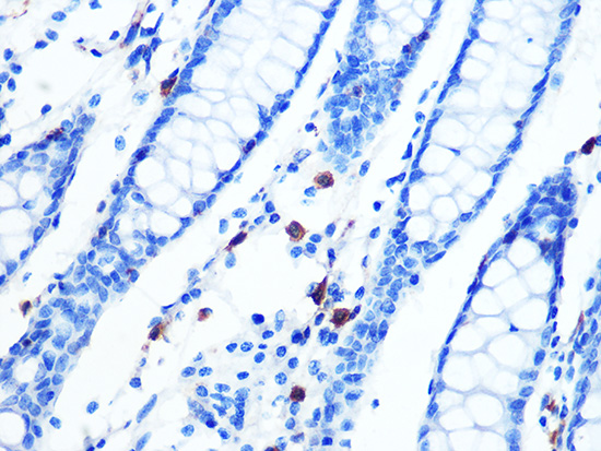 Moesin Rabbit monoclonal antibody