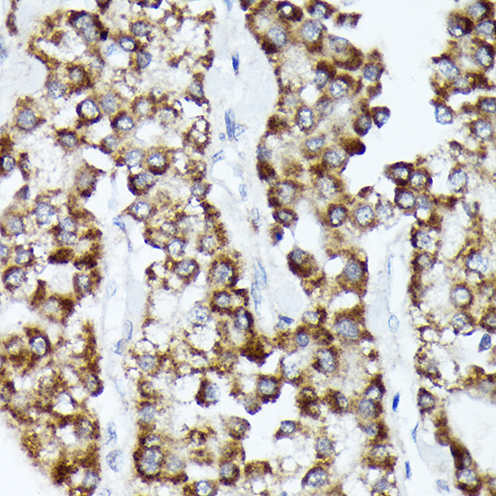 CDCA3 Rabbit monoclonal antibody