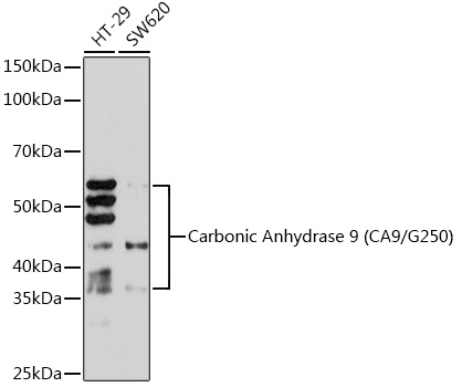 Carbonic Anhydrase 9 (CA9/G250) Rabbit monoclonal antibody