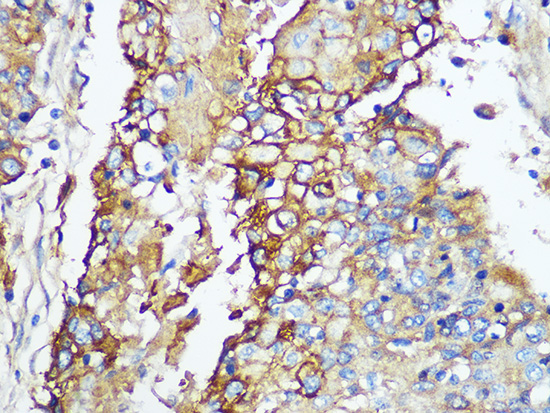 Carbonic Anhydrase 9 (CA9/G250) Rabbit monoclonal antibody