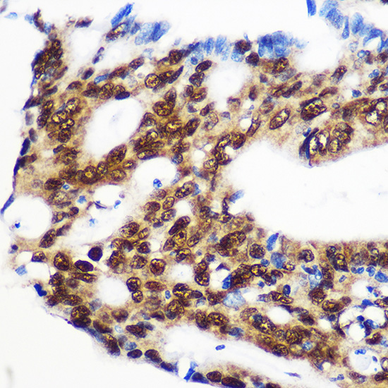 RBM15 Rabbit polyclonal antibody