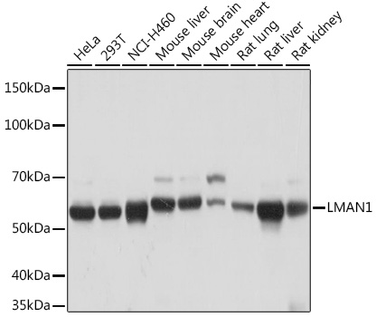 LMAN1 Rabbit monoclonal antibody