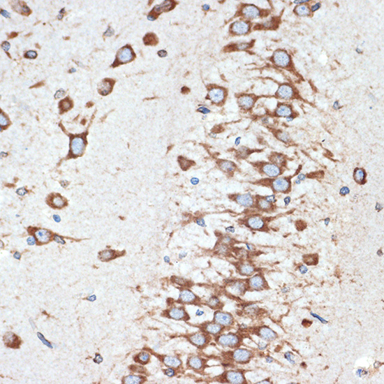 LMAN1 Rabbit monoclonal antibody