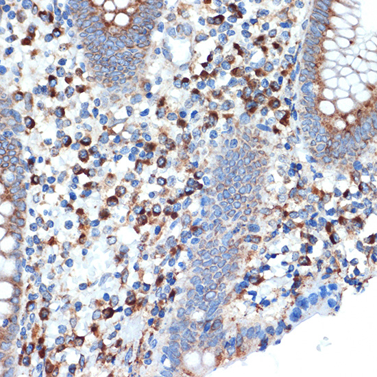 LMAN1 Rabbit monoclonal antibody