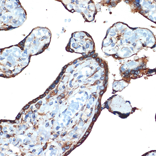 LMAN1 Rabbit monoclonal antibody