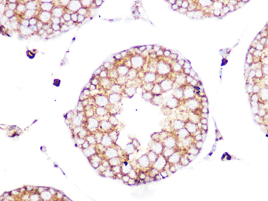 Clathrin heavy chain Rabbit monoclonal antibody
