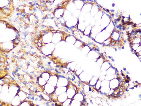 Clathrin heavy chain Rabbit monoclonal antibody