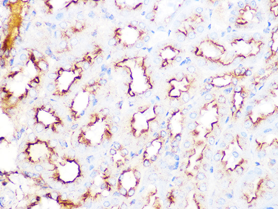 Clathrin heavy chain Rabbit monoclonal antibody