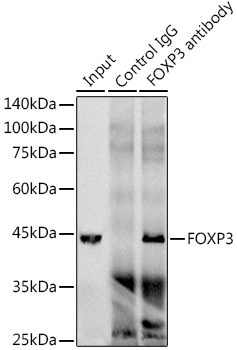 FOXP3 Rabbit monoclonal antibody