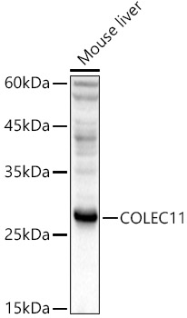 COLEC11 Rabbit polyclonal antibody