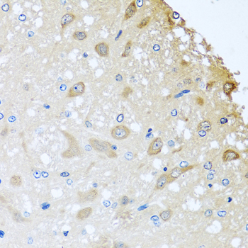 COLEC11 Rabbit polyclonal antibody