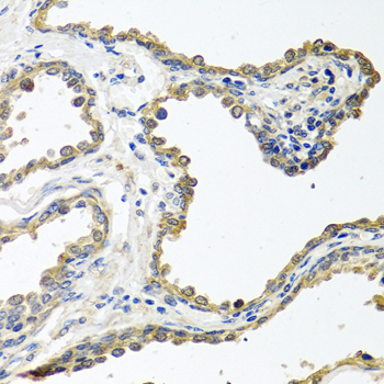 COLEC11 Rabbit polyclonal antibody