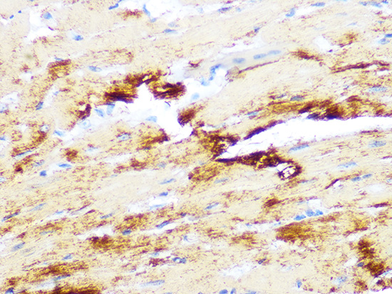 Myosin heavy chain Rabbit monoclonal antibody