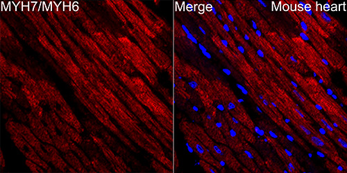 Myosin heavy chain Rabbit monoclonal antibody