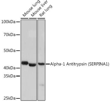 Alpha-1 Antitrypsin (SERPINA1) Rabbit mAb