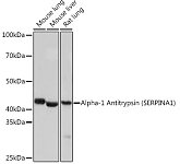 Western blot - Alpha-1 Antitrypsin (SERPINA1) Rabbit mAb (A4966)
