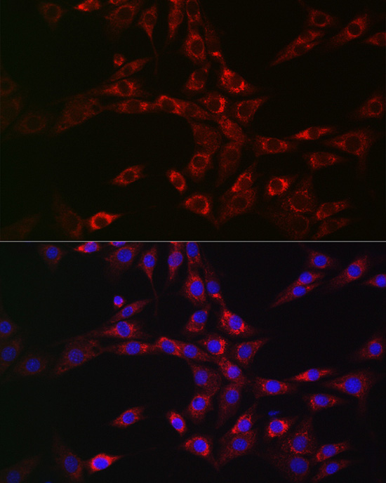 CHMP6 Rabbit polyclonal antibody