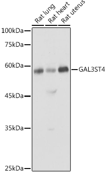 GAL3ST4 Rabbit polyclonal antibody