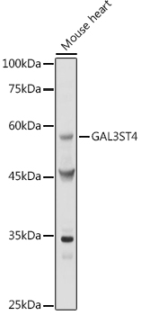 GAL3ST4 Rabbit polyclonal antibody