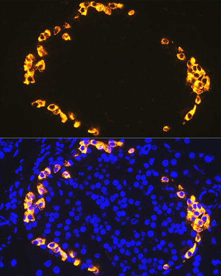 GLP-1 Rabbit monoclonal antibody