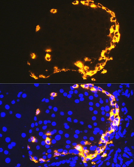 GLP-1 Rabbit monoclonal antibody