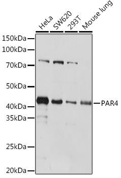PAR4 Rabbit monoclonal antibody