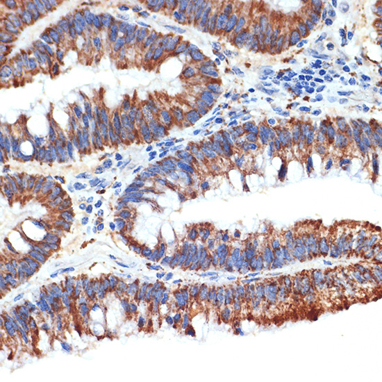 PAR4 Rabbit monoclonal antibody
