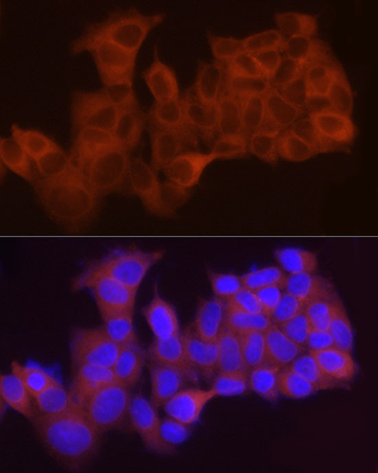LPCAT1 Rabbit polyclonal antibody